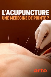 L’acupuncture, une médecine de pointe ?