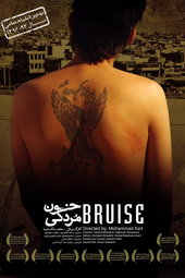 Bruise