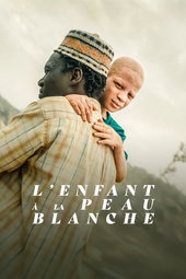 L'Enfant à la Peau Blanche