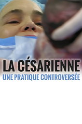 La césarienne - une pratique controversée