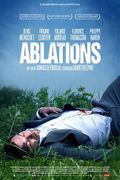 Ablations